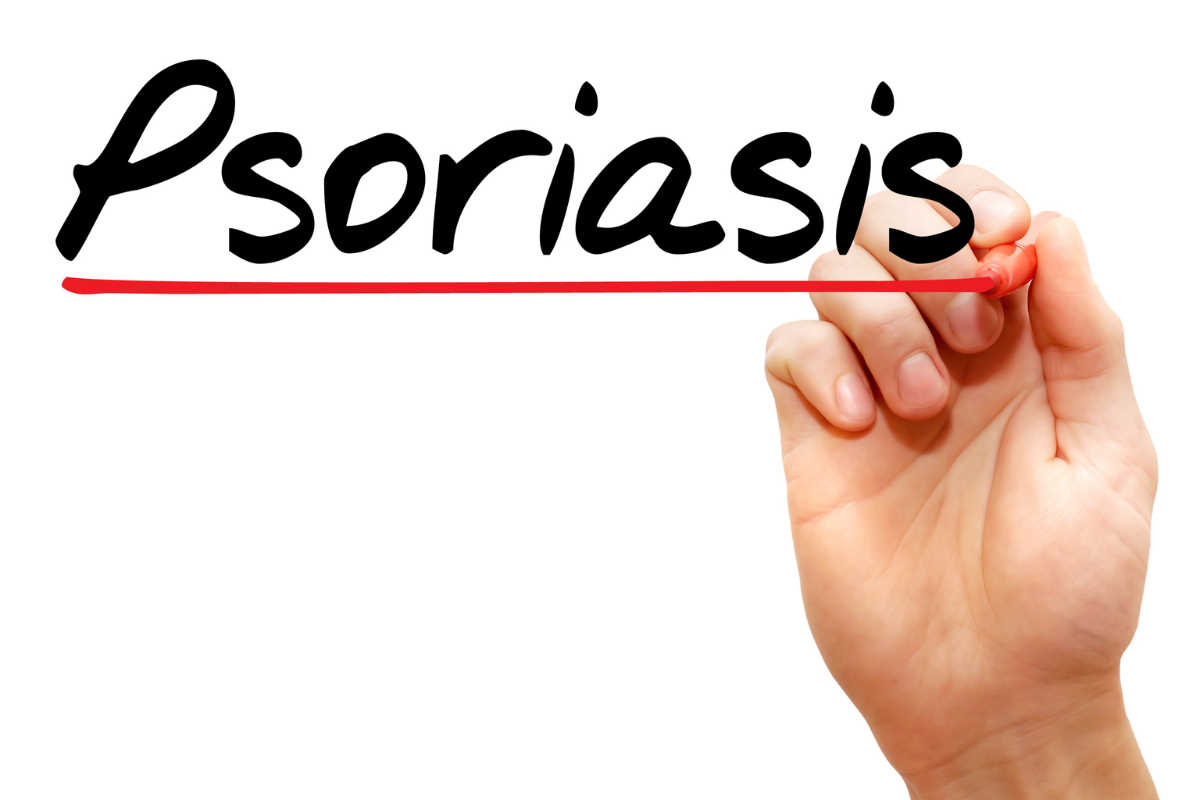 Psorijaza: Kako prepoznati ovu kroničnu kožnu bolest?